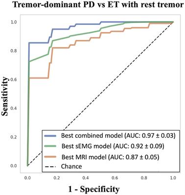 Multimodal imaging and electrophysiological study in the differential diagnosis of rest tremor